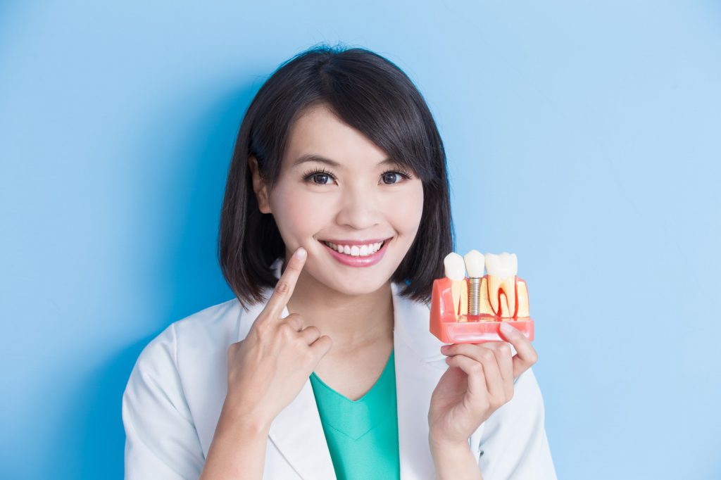 Top Reasons For Choosing Dental Implants - Syndication Cloud