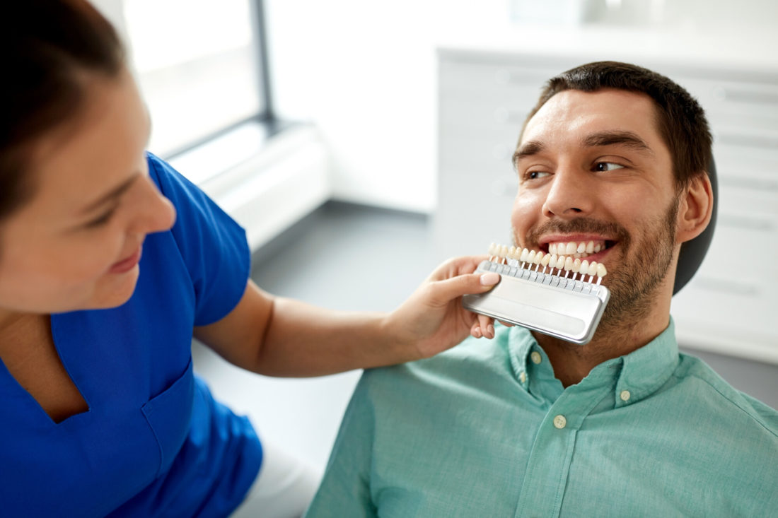 Dental Veneers Before and After: Stunning Smile Transformations